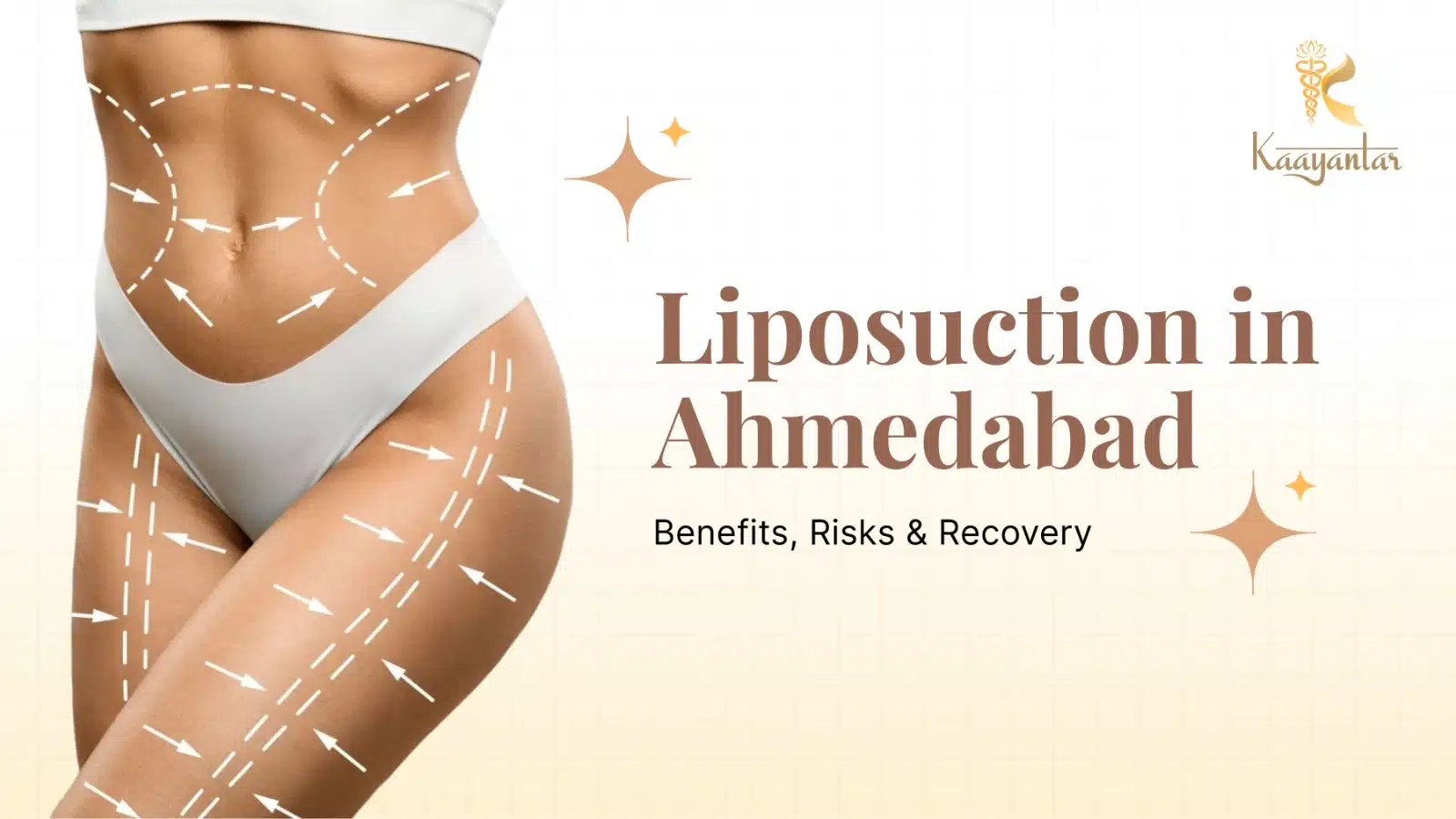 Liposuction in Ahmedabad
