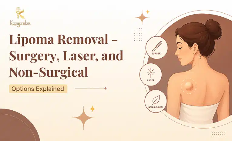 Lipoma Removal Surgery, Laser, and Non-Surgical Options Explained