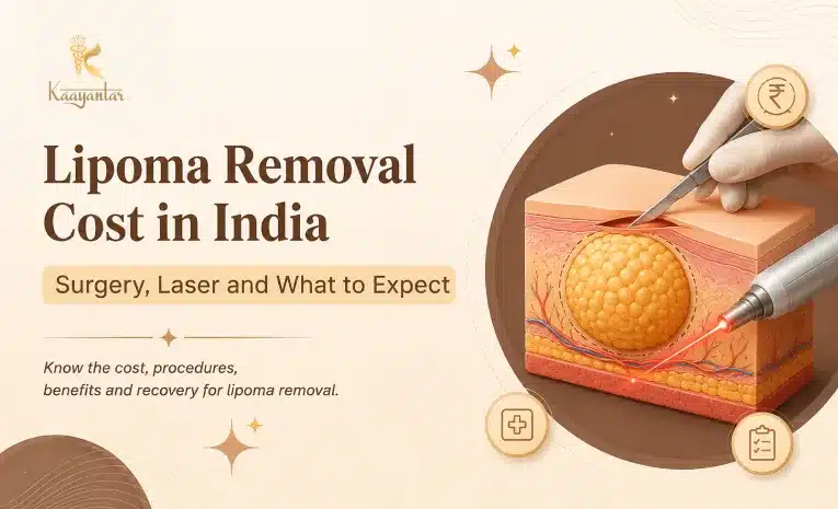 Lipoma Removal Cost in India, Surgery, Laser, and What to Actually Expect